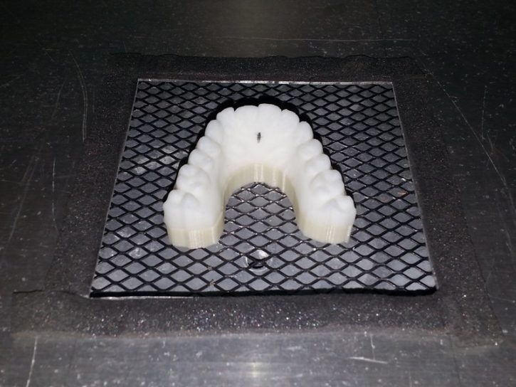 Appareil dentaire 3D
