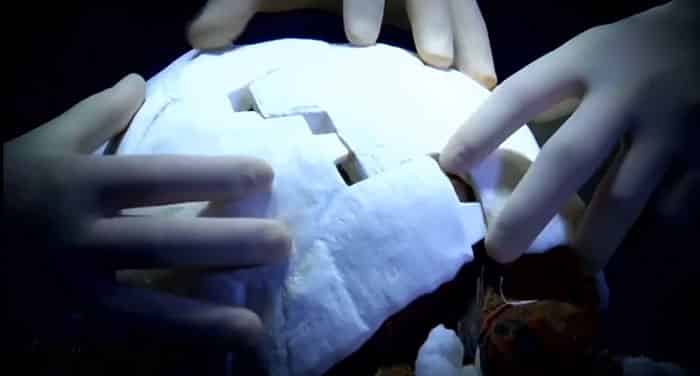 Carapace de tortue imprimee en 3D